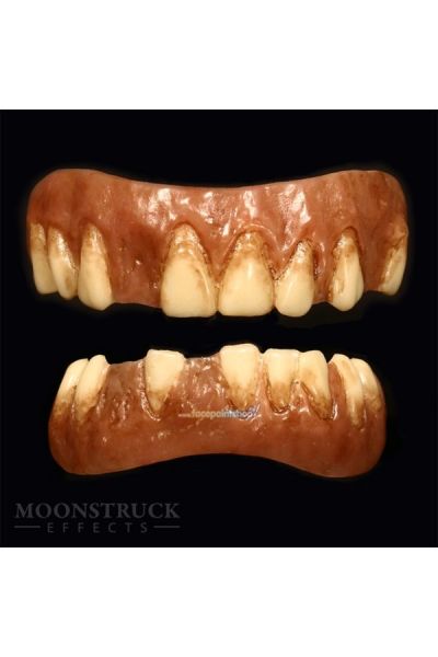 Dientes de Igor Moonstruck