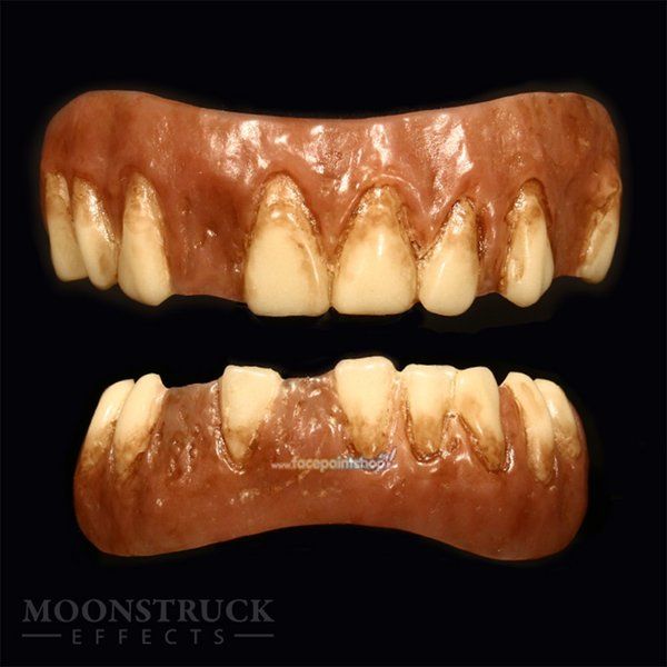 Dientes de Igor Moonstruck